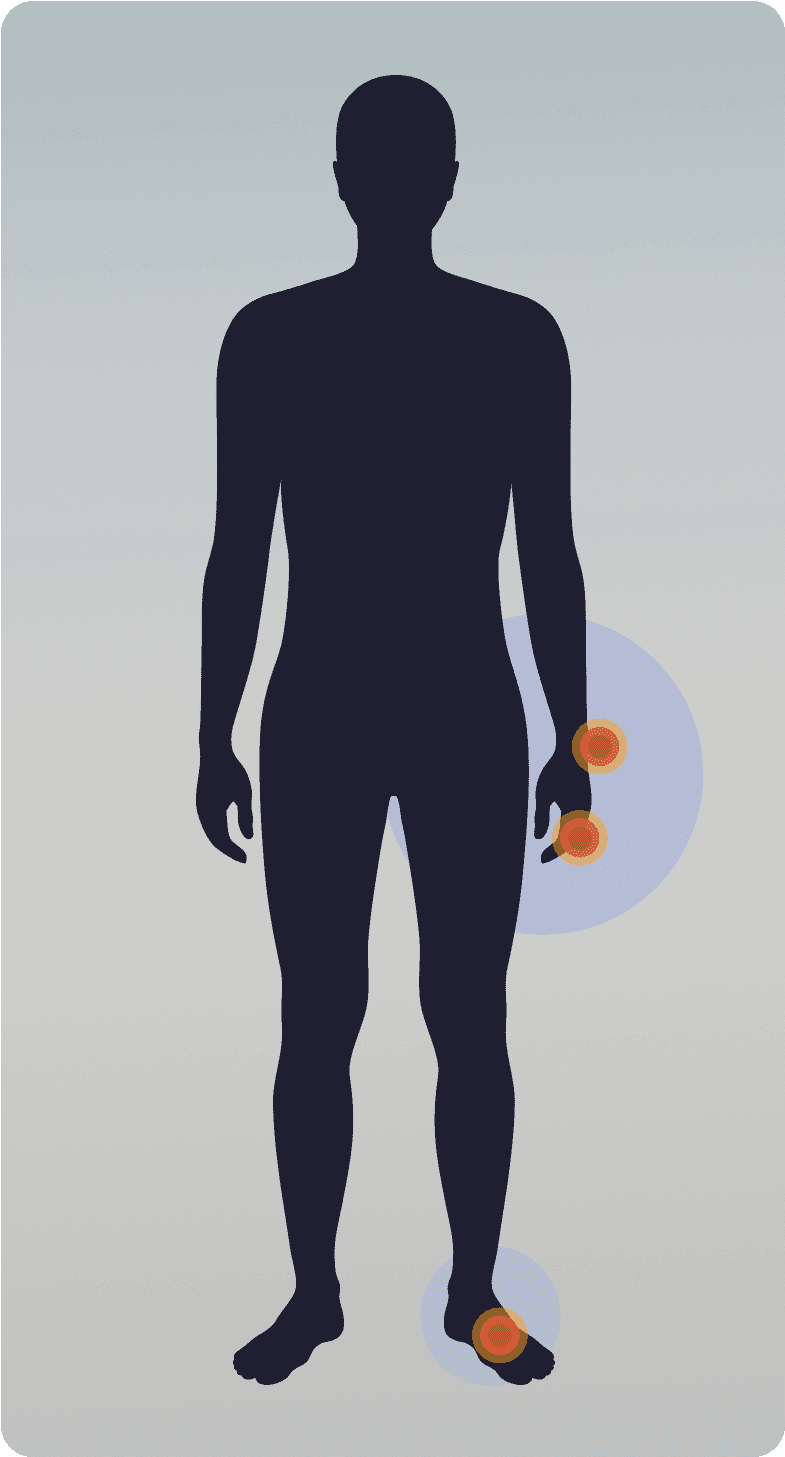 silhouette of the human body highlighting areas where tgcts can occur such as wrists, fingers, and feet